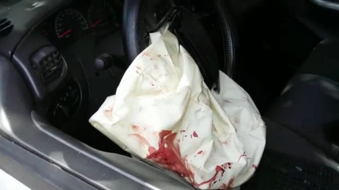 Conductor distraído, es chocado por moto y ambos acaban en el hospital.