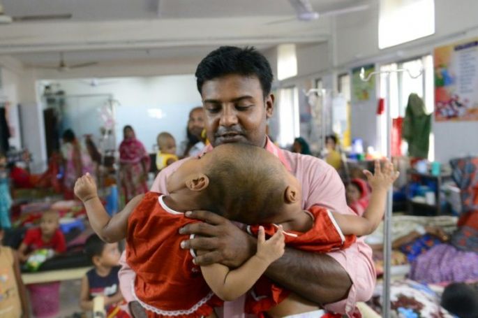 Gemelas unidas por el cráneo, serán sometidas a una cirugía en Bangladesh.