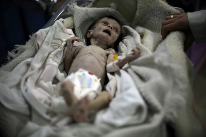 La ONU, "consternada" por fotos de niños esqueléticos en Siria