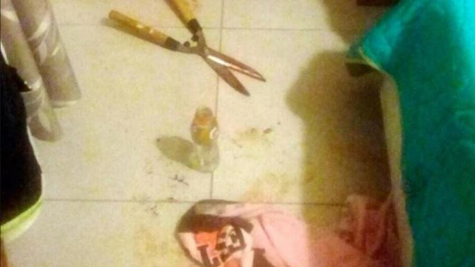 Detenida en Argentina por cortar el pene y los testículos a su amante con una tijera de podar 