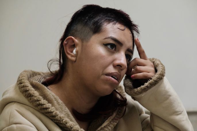 Le salvan la vida en el IMSS a mujer que recibió un balazo en la cabeza