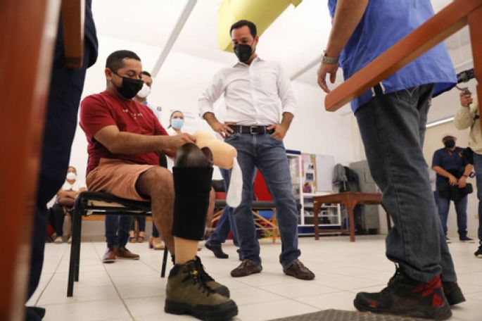 Mejora la vida de más personas con discapacidad en Yucatán, con las prótesis y órtesis que otorga el Gobierno del Estado