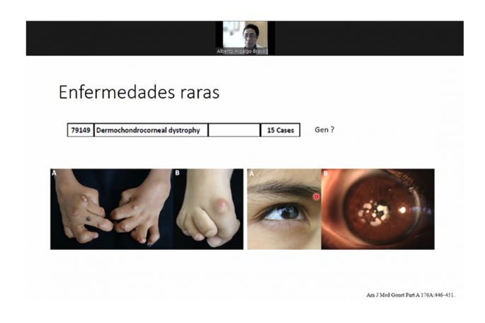 Análisis genético permite diagnóstico de enfermedades raras  