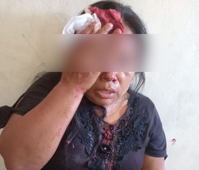 PRI denuncia acto de violencia contra una pobladora de Tixcacalcupul por parte de Morena